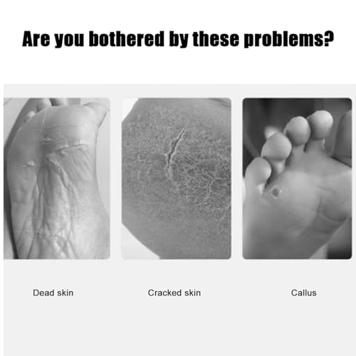 Foot Peeling Gommage Cream for Dry Feet with Calluses (150ml)