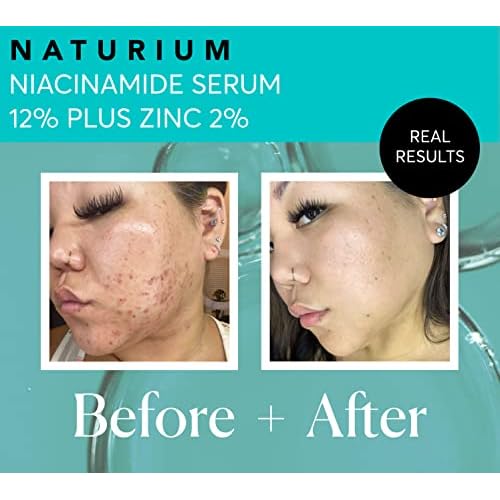 Naturium Niacinamide Face Serum 12% Plus Zinc 2% Jumbo, Anti-Aging, Pore Minimizer & Dark Spot Corrector with Hyaluronic Acid & Vitamin E, Vegan & Cruelty-Free, 2 oz