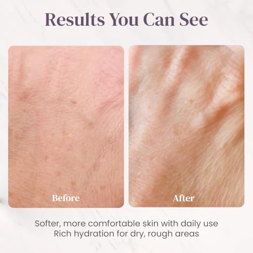 IKI Skincare Body Repair Balm for Sensitive Dry Skin 120ml - Nourishing Moisturizer & Skin Barrier Repair