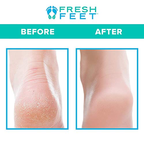 Foot Scrubber with Pumice Stone - Shower Foot Exfoliator & Massager