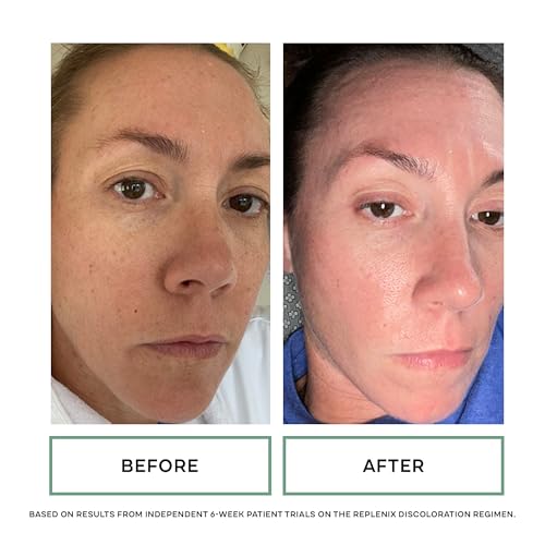 Glycolic Acid Facial Cleanser - Gentle Exfoliating Skin Wash for Discoloration 6.7oz