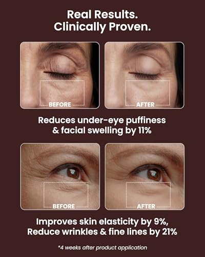 Ice Roll Serum for Face & Under Eyes - Double Elasticity Variant with Collagen & Bakuchiol