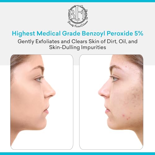 Acne Face Wash Treatment with 10% Benzoyl Peroxide for Oily Skin & Breakouts