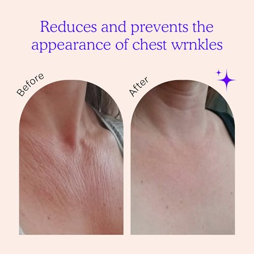 BLUMBODY Reusable Silicone Chest Wrinkle Patches - 2 Pack for Side Sleep Lines