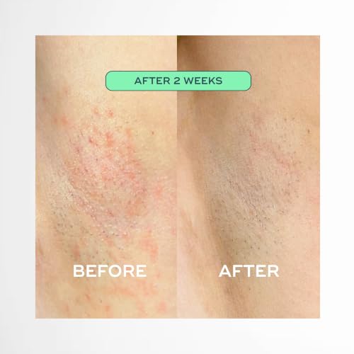 Luna Daily Ingrown Hair Oil 1 Fl Oz - Razor Bump & Redness Relief, Pack of 1