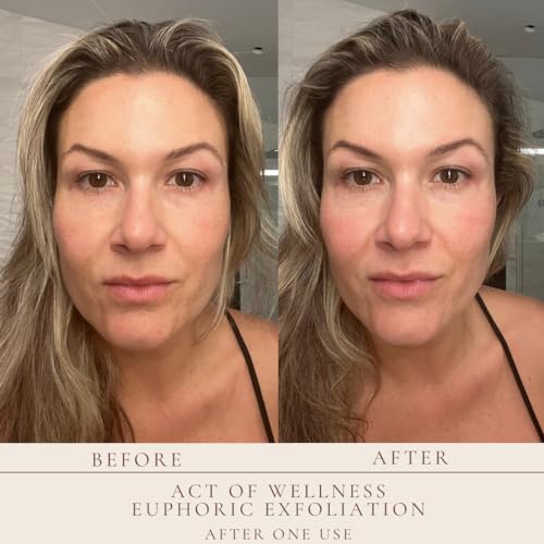 Euphoric Exfoliation Weekly Exfoliating Facial Treatment Peel for Soft and Baby Smooth Skin - with Lactic and Glycolic Acid - Vegan (2oz and 1oz)