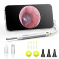 Silver Digital Otoscope Ear Camera with HD Video & LED Lights for iPhone & Android