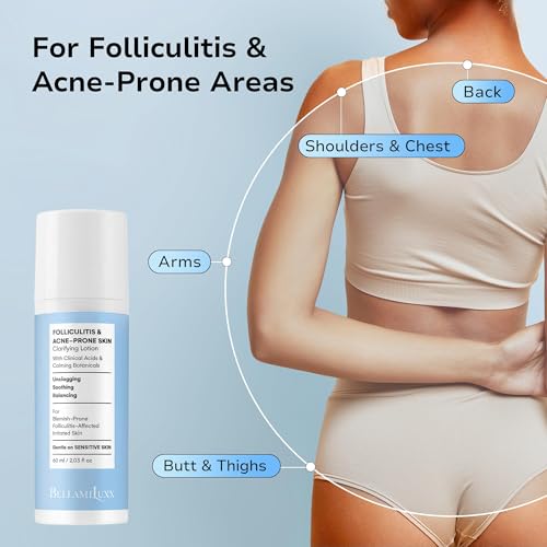 Folliculitis Treatment Lotion 1 Pack - Calming Body, Scalp & Face Care with Salicylic & Glycolic Acid