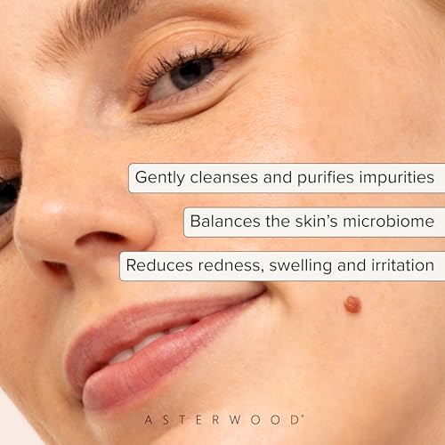 Asterwood Hypochlorous Acid Spray for Face - Targets Acne, Redness, Irritation - Multi-Purpose Skin Repair - Antibacterial, Antimicrobial - After Gym/Post-Workout Facial Mist - 4 Fl Oz