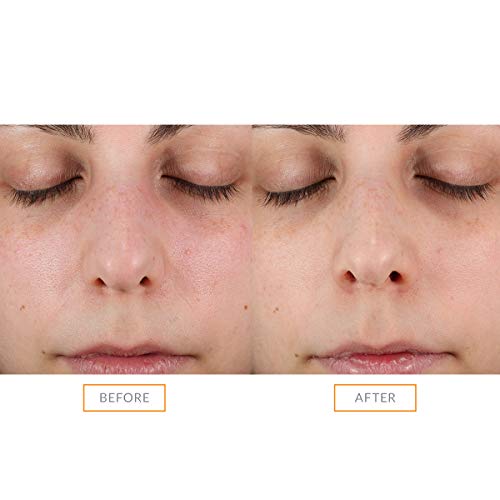 Clarisonic Sonic Face Exfoliator Cleansing Brush Head | Gentle Exfoliating Brush to Brighten Skin | Suitable for Sensitive Skin
