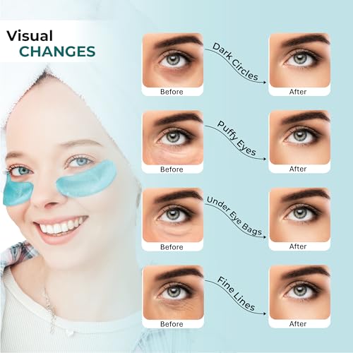 Envy: Collagen & Peptides - Sheet Mask
