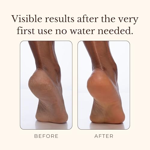 Juara Candlenut Body Polish 7.5 Fl Oz - 2-in-1 Exfoliating & Moisturizing Body Scrub with Candlenut Oil & Rice Bran