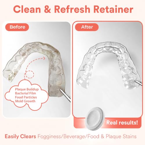 Dye-Free Retainer & Night Guard Cleaning Tablets - Mint Scent, 120 Count (4-Month Supply) - Invisalign & Odor Removal