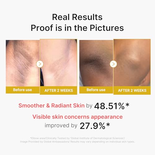 Medicube Body Peel Shot with Kojic Acid, Turmeric – 9.46 Fl Oz