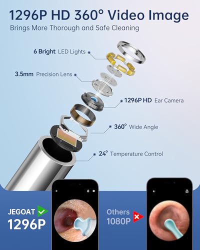JEGOAT Midnight Blue 1296P HD Ear Wax Removal Camera with Smartphone App