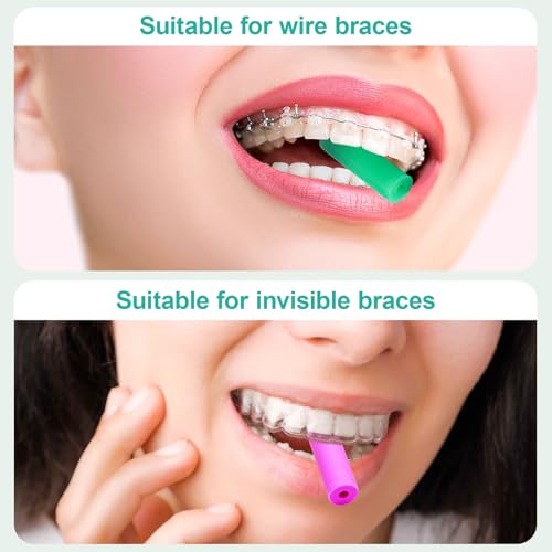 200 Pack Soft Silicone Aligner Chews for Invisalign - Mix Colors