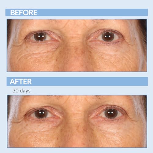 Serious Skincare - Retinol A Eye XR Under Eye Cream Concentrate - Reduce Fine Lines, Dark Circles & Puffiness - Daily Wrinkle Cream - Anti-Aging Skin Care Treatment for Women and Men - 0.5 oz