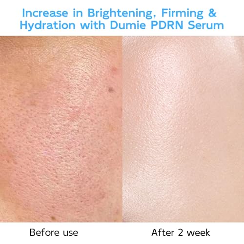 Dumie Salmon DNA PDRN Anti-Aging Serum with Collagen & Hyaluronic Acid, Korean Skin Care for Wrinkles & Radiance, 30 Pack