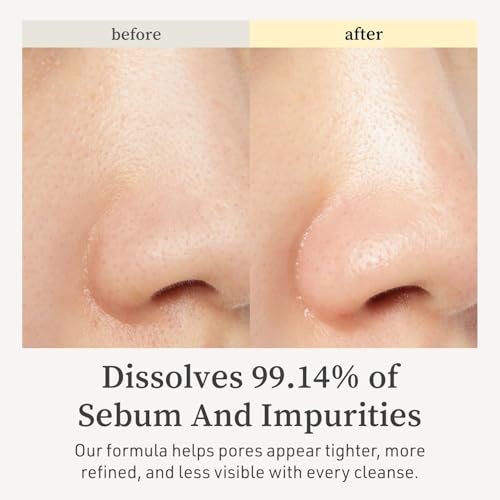 NOONI Snow Aqua 0 LHA Toning Cleansing Oil - Makeup & Blackhead Remover