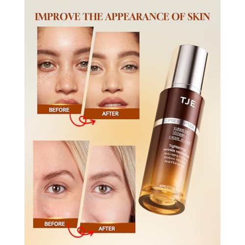 TJE Vitamin C Serum for Face, Serum for Wrinkles,Firming & Dry Skin, Dark Spot Corrector on Face, Brightening Serum & Pore Minimizer For Face, Post Acne Skin Barrier Repair - 1 Fl Oz