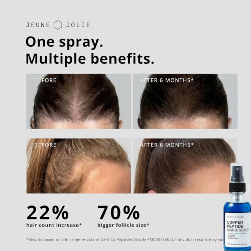 Copper Peptide Hair Growth Serum for Thicker, Fuller Hair - Scalp & Hair Loss Treatment