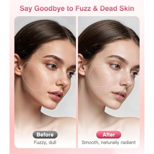 Sonic Dermaplane for Women Face, Dermaplane Razor for Women with LED Light, Rechargeable Facial Hair & Peach Fuzz Remover, 4 Refill Dermablades & 2 Microsmooth Exfoliation Tips, Pink