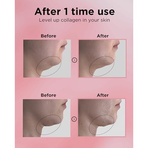 EASYDEW DW-EGF 55% Collagen Silkream Ampoule- Korean Facial Serum for Firmness & Elasticity with EGF Peptides, Amino Acids - Day & Night Age-Defying Silky Smooth Skincare, 1.86oz.