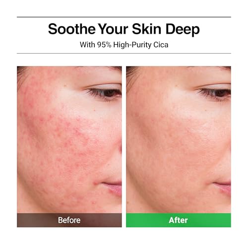 Calming Cica Face Serum - Soothing Trouble Skin Relief, 1.69 fl oz