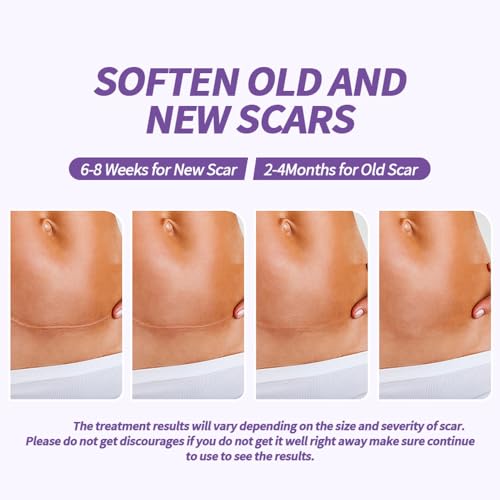Medical Grade Silicone Scar Sheets - Reusable 1.6" x 60" Scar Removal Tape with Natural Variant