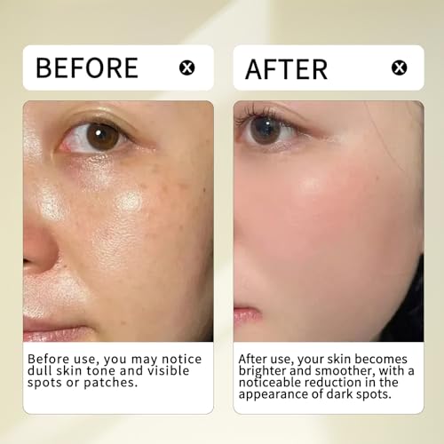 Luminous 24% Serum-10% Niacinamide & 7% Arbutin - 4% VC Ethyl Ether & 3% Tranexamic Acid - 24% Active Formula for Brightening, Visible Dark Spots & Even Skin Tone