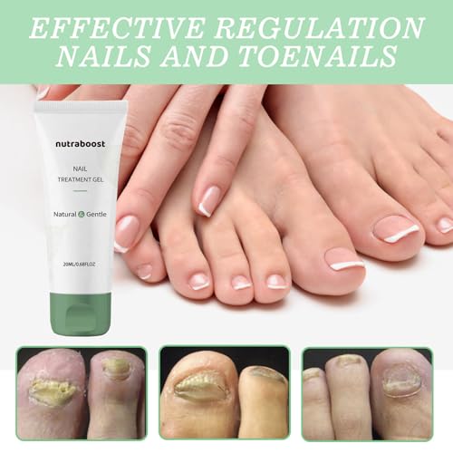 Blinzador ? Natural Spray for Foot & Nail with Plant-Based Ingredients ? Fast-Drying, Odorless, Easy-to-Use | 1oz (30ml), 1 Month Supply