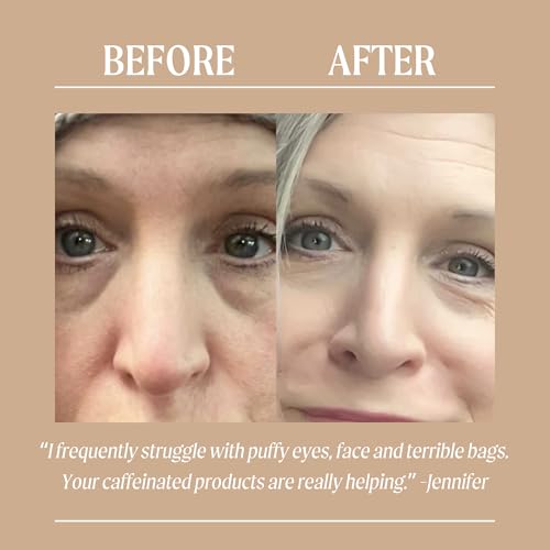 UpCircle Natural Eye Cream with Coffee & Hyaluronic Acid for Dark Circles & Puffiness - Vegan & Cruelty-Free, 0.5 FL OZ