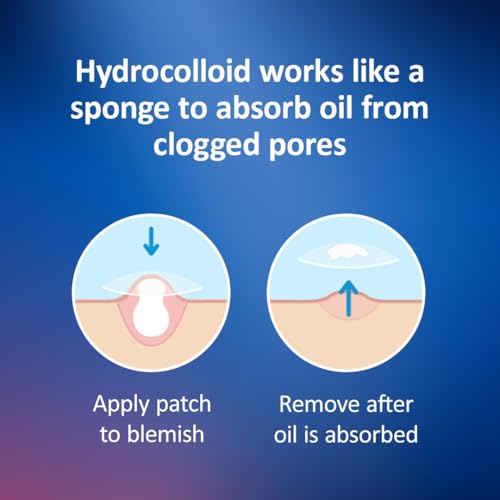 Hydrocolloid Acne Patches - Clear Spot Covers for Breakouts, 216 Pack
