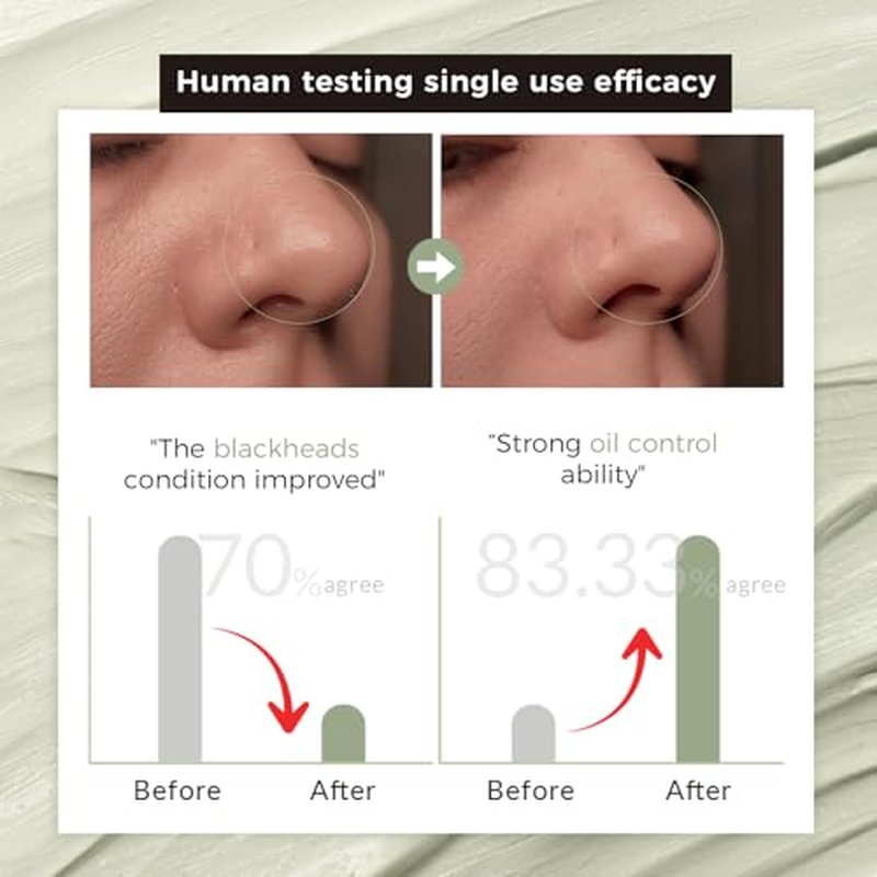 Emu Oil Moisturizing Lip Balm - Hydrating Lip Balm with Extreme SPF50+ Sun Protection - 4-Hour Water Resistant, Fortified with Vitamin E, Amino Acids & Omega 3, 6 & 9 - Y-Not Natural, 15g Stick