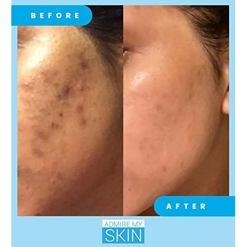 Admire My Skin Dark Spot Corrector Serum + Retinoid Cream Set