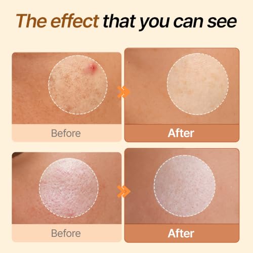 Vitamin C Serum for Dark Spots & Pore Care - Brightening & Toning