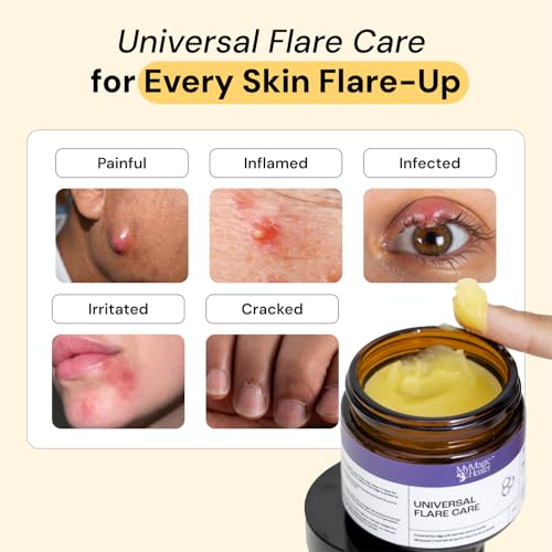 Complete Flare Care | Universal Flare & Thyme & Tea Tree Flare Care | Dual Relief for HS, Boils, Cystic Acne, Ingrown hair, Razor Bumps, Pimples, Abscesses & More | Drawing Salve (2 x 1oz)