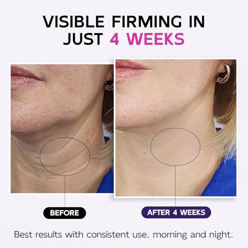 Tighten & Lift Neck & Chest Moisturizer Cream, 4.3 fl oz -2 Pack, Neck Firming Cream with Roller for Crepey Skin Body Care Comfort, Skin Firming Cream Reduces the Look of Fine Lines and Wrinkles