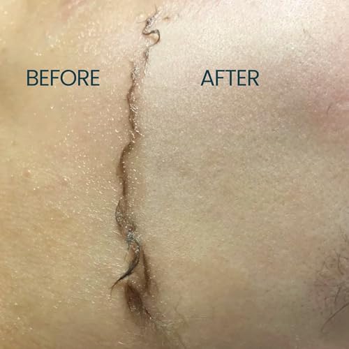 Dermaplane Oil for Sensitive Skin - Hydrating Face Shaving Oil for Women - Safe for Acne Prone Skin - Non Comedogenic, Fragrance Free, Natural, Hypoallergenic for Pre & Post Dermaplaning 2oz by Ouiloe