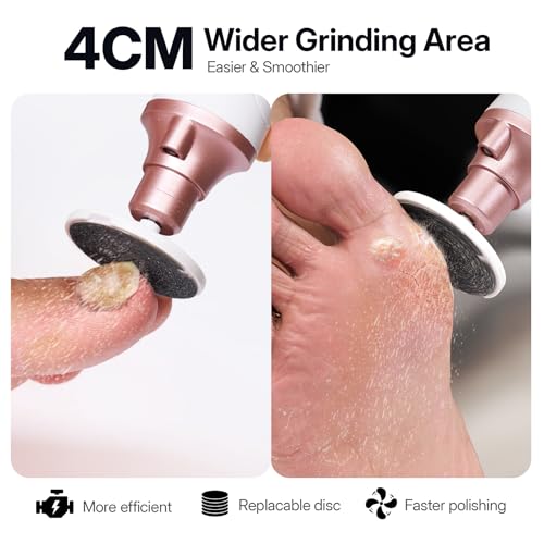 White Electric Toenail Grinder Set - 15X Professional Cordless Pedicure & Callus Remover