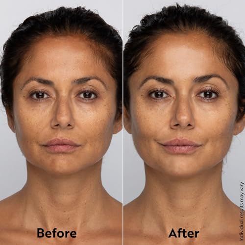 Vitamin C Face Moisturizer for Radiant Skin - Hydrating & Protecting Cream