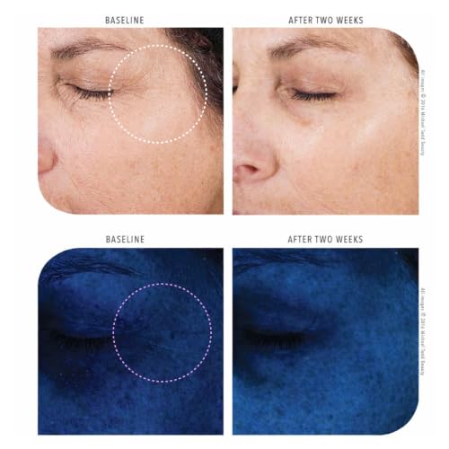 Face Lifting & Brightening Serum with Peptides & Snail Secretion - 30ml