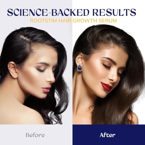 RootStim Hair Growth Serum with Biotin & Herbal Extracts - Thinning Hair Treatment for Men & Women