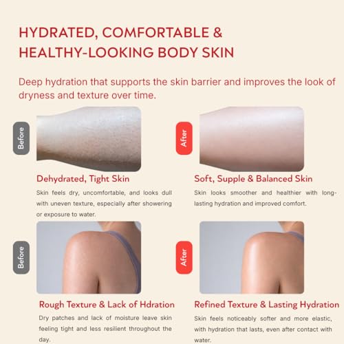 Summer Skin Body Serum - Hydrating Body Lotion for Dry Skin with Niacinamide, Vitamin B5 + Oat Extract, Fast Absorbing, Non-Greasy, Body Lotion for Women 150ml