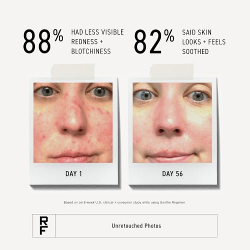 Rodan + Fields Soothe Moisturizing Rescue Cream - 1.7 Fl Oz Hydrating Face Moisturizer