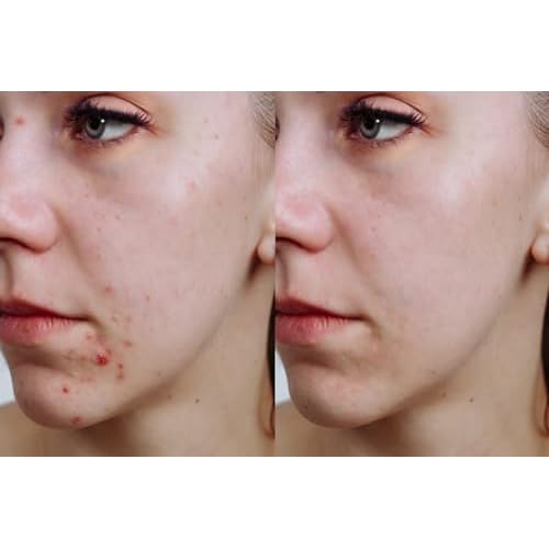 Vitality Precision Skin Vitamin C Pumpkin Enzyme Mask