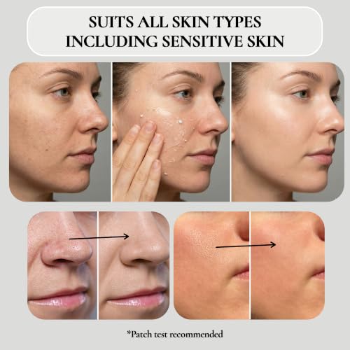 Facial Peeling Gel for Dead Skin Removal - Gentle Exfoliator 4.05 Oz Pack of 2