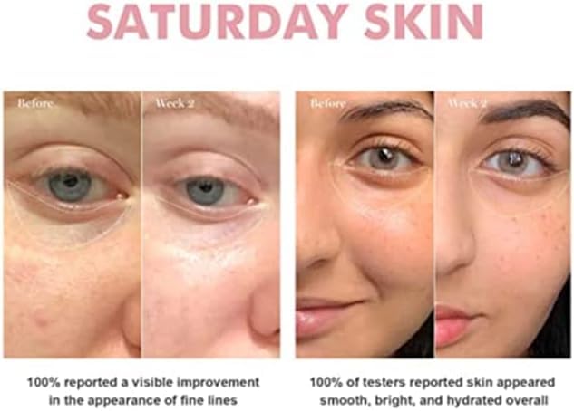 Saturday Skin Wide Awake Anti-Aging Eye Cream 1.01 Fl Oz - Brightening, Hydrating, Dark Circles