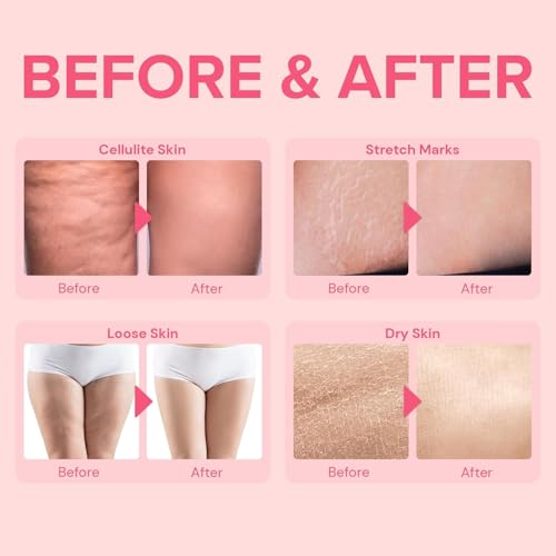 Enaskin Naturals Anti Cellulite Body Firming Cream: Cellulite Remover for Legs & Inner Thigh- Skin Tightening Lotion for Womens' Booty, Stomach & Belly with Acetyl Hexapeptide-8 & Caffeine, 100 ML