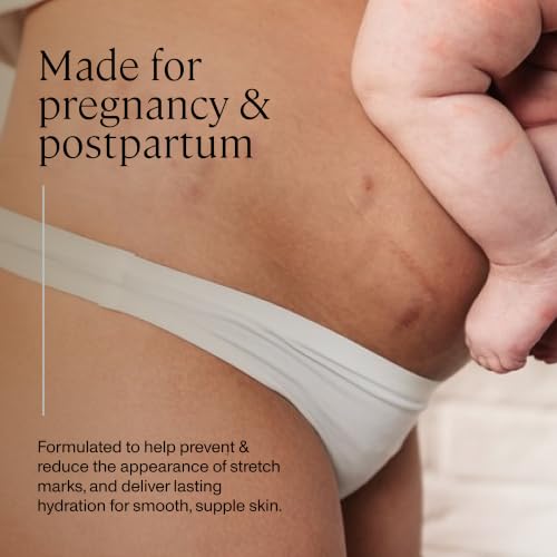 Anya Body Butter - 5 oz Moisturizing Cream for Skin & Stretch Marks - Variation of Body Butter
